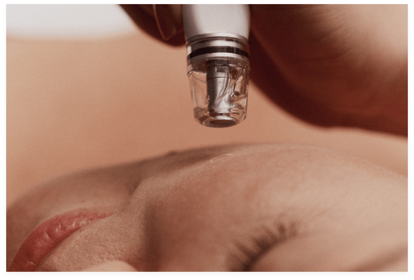 Diamondglow facial - Featured Service Image