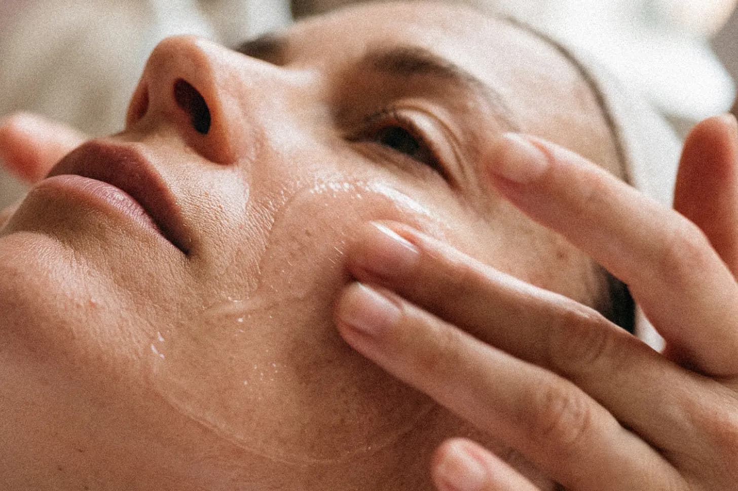 Service Detail Page-Who Benefits-Peel Facial