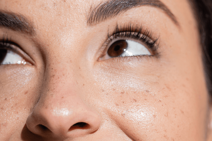 Service Detail Page-Who Benefits-Peel Facial