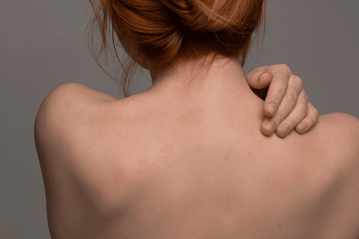 Service Detail Page-Who Benefits-Back Treatment