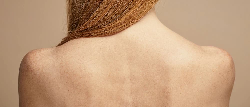 Service Page Back Hair Removal