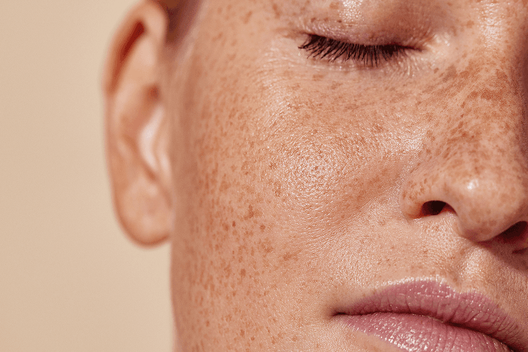 Service Page Wrinkle Relaxer