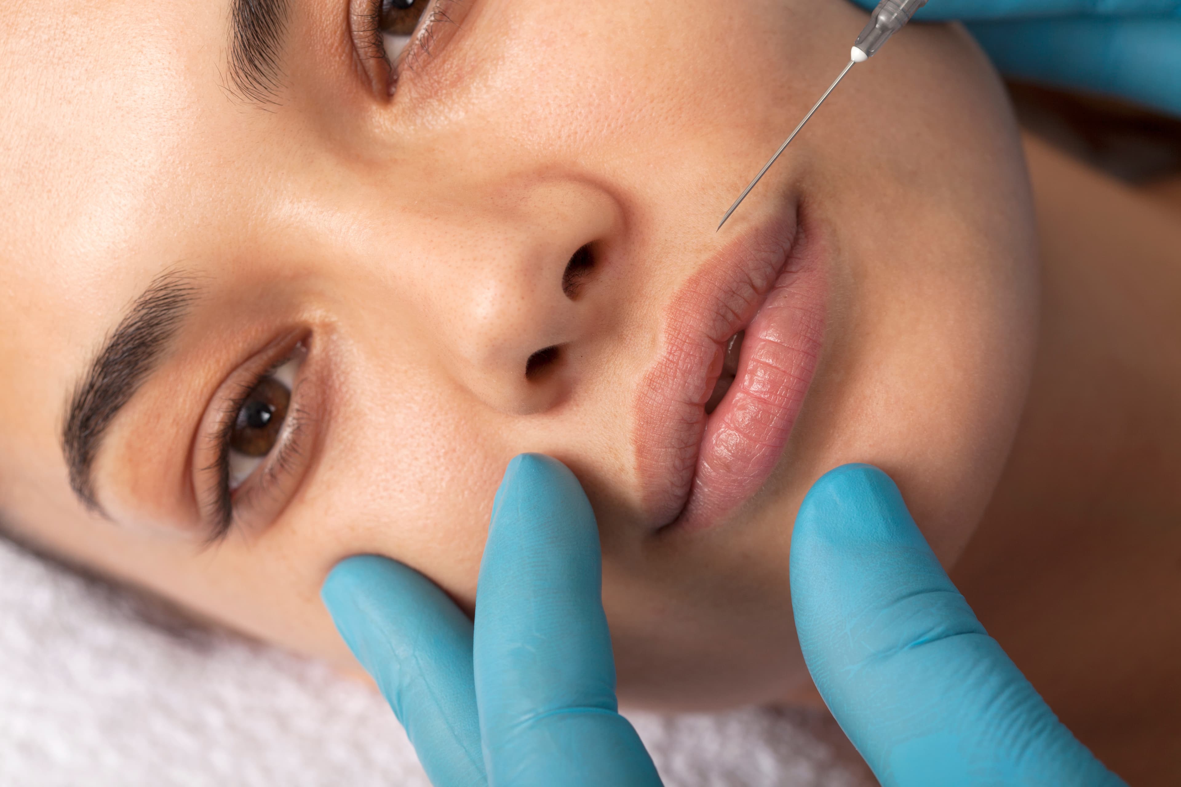 Service Detail Page-What's Included-Injectables-Lip Filler
